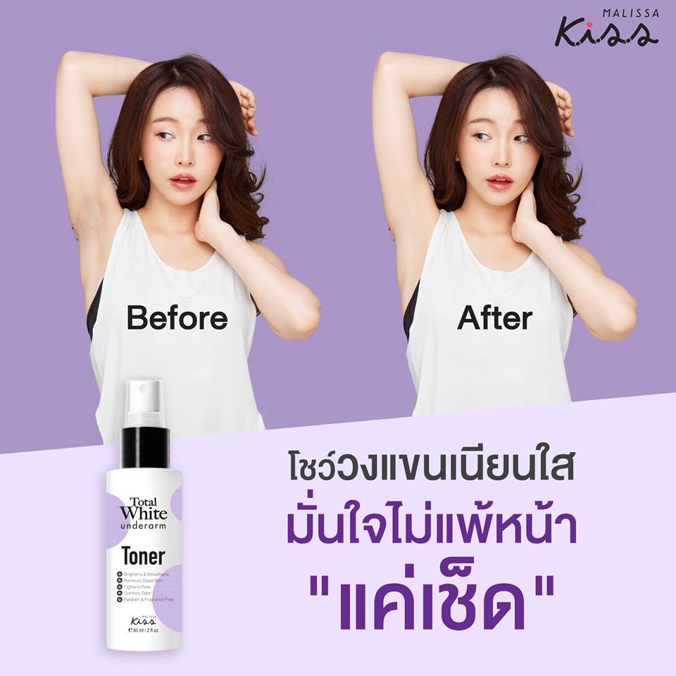 Malissa Kiss Total White Underarm Toner