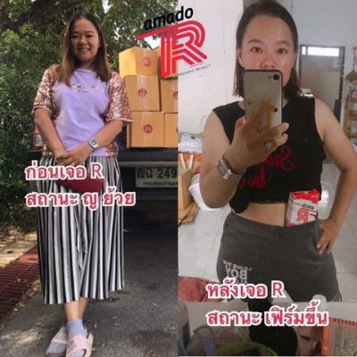Amado R Dietary Supplement - Thailand Best Selling Beauty Products - No ...
