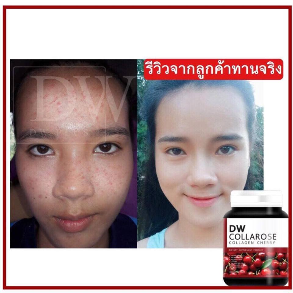 DW Collarose Collagen Cherry