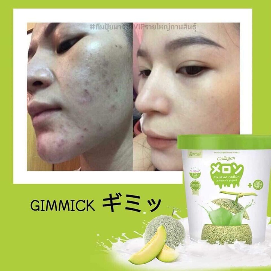 Gimmick Collagen Smoothie Yogurt