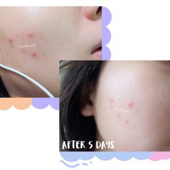 Dr.Somchai Acne Repair Cream