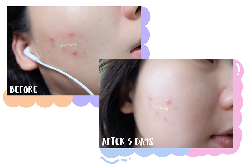 Dr.Somchai Acne Repair Cream