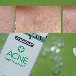 Dr.Somchai Acne Spot Touch Gel