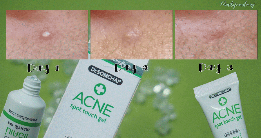 Dr.Somchai Acne Spot Touch Gel