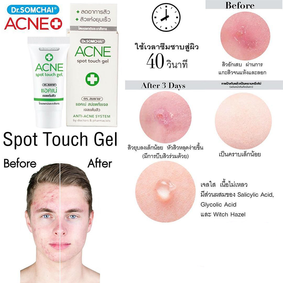 Dr.Somchai Acne Spot Touch Gel