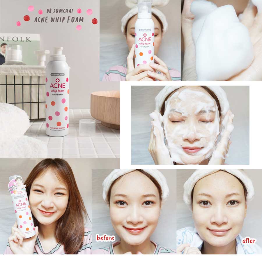 Dr.Somchai Acne Whip Foam For Oily Skin