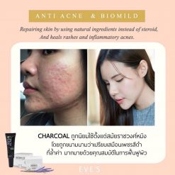 EVE'S Anti Acne Charcoal Cream