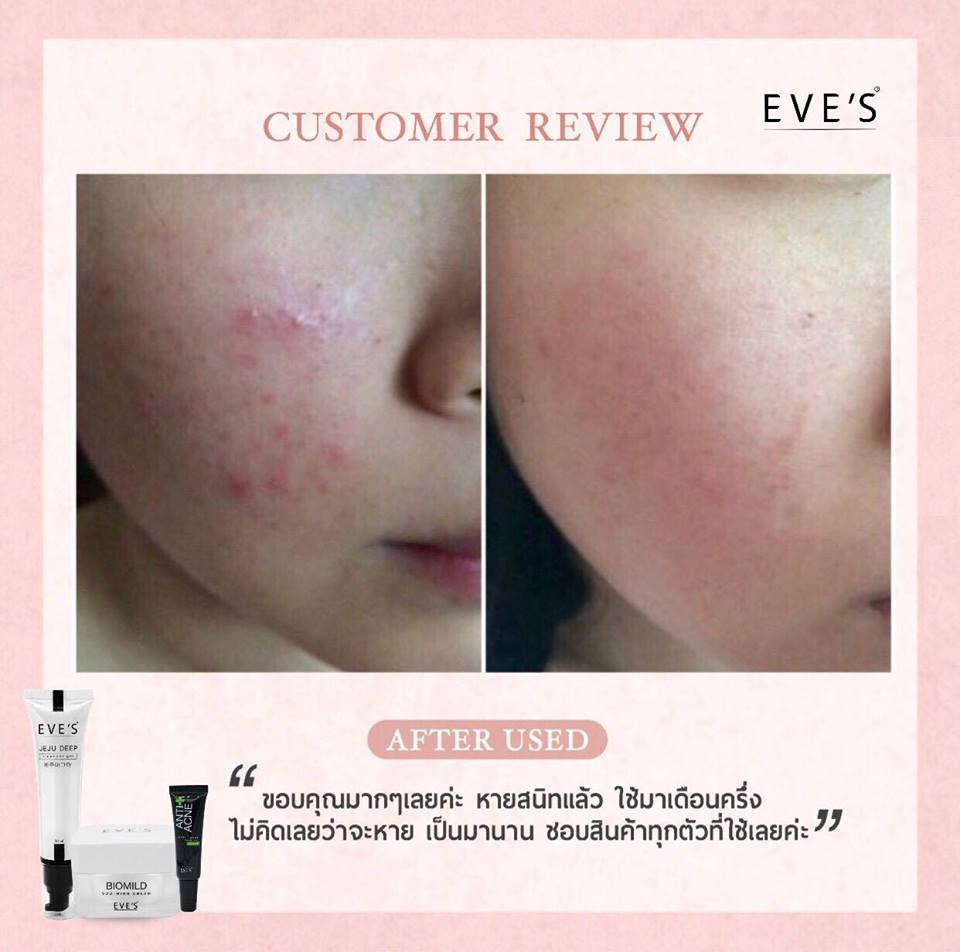 EVE'S Jeju Deep Cleanser Gel