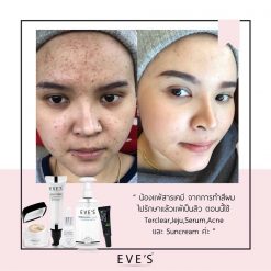 Eve's Biomild Soothing Cream