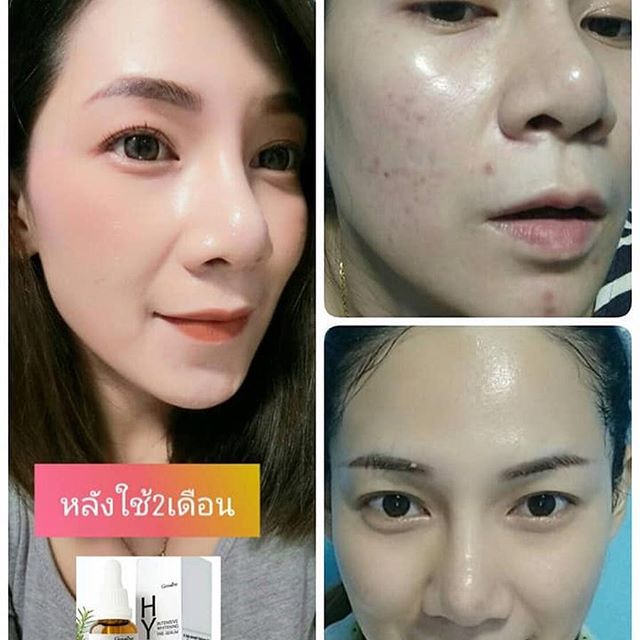 Hya Intensive Whitening Pre-Serum