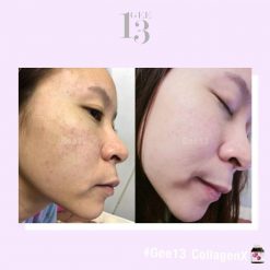 Gee13 Collagen X