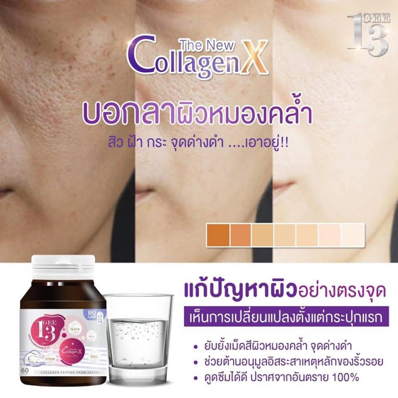 Gee13 Collagen X