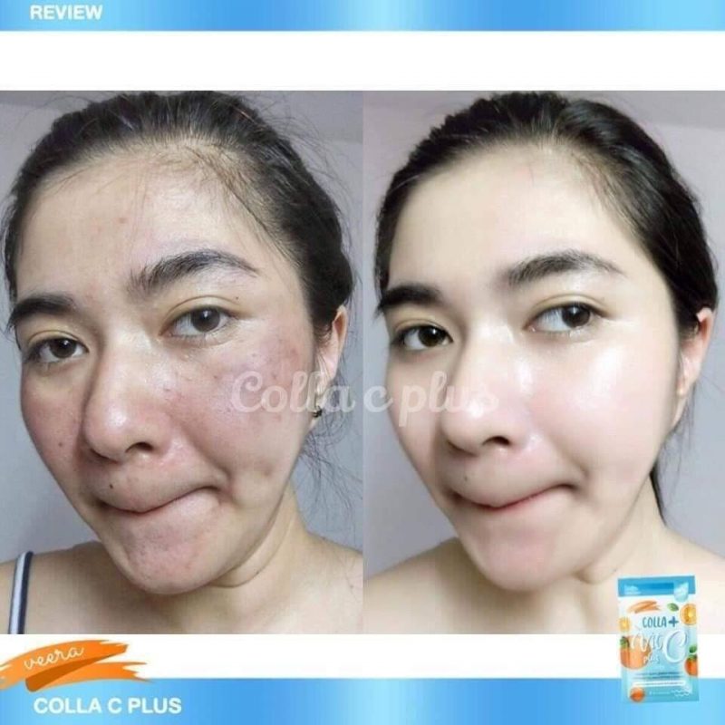 Veera Colla Vit C Plus