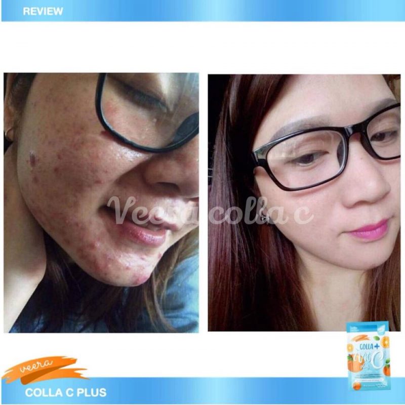 Veera Colla Vit C Plus