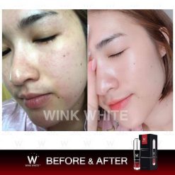 White Essence by Wink White