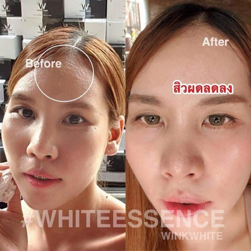 White Essence By Wink White Thailand Best Selling Products Online Shopping Worldwide Shipping