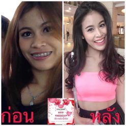 YUUKI Collagen Snowy by IDAKA