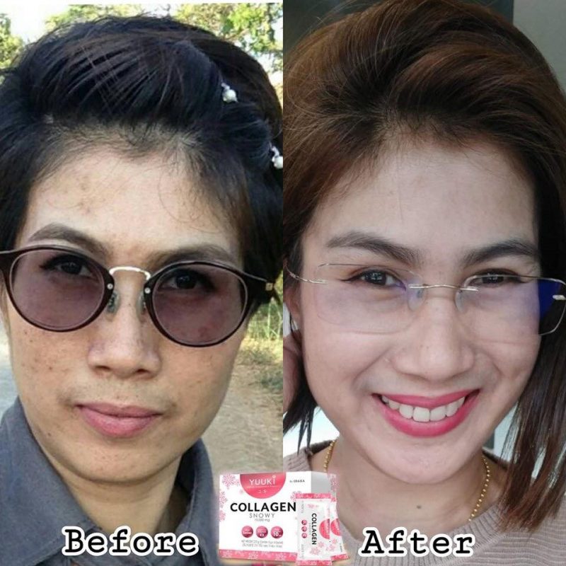 YUUKI Collagen Snowy by IDAKA
