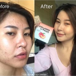 Collagen My Peach by Fonnfon