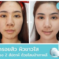 Let Me In Beauty Serum