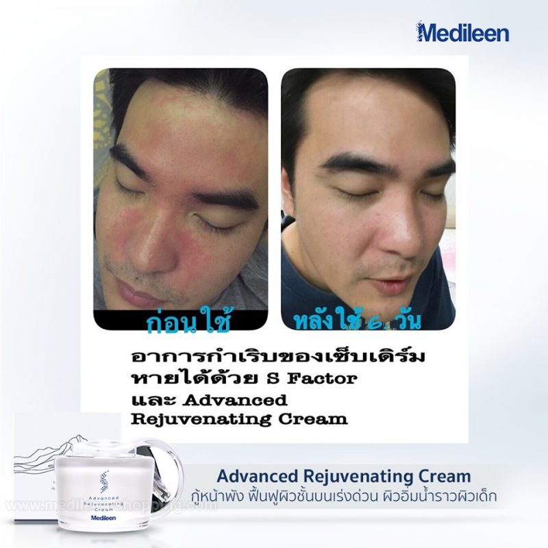 Medileen Advanced Rejuvenating Cream