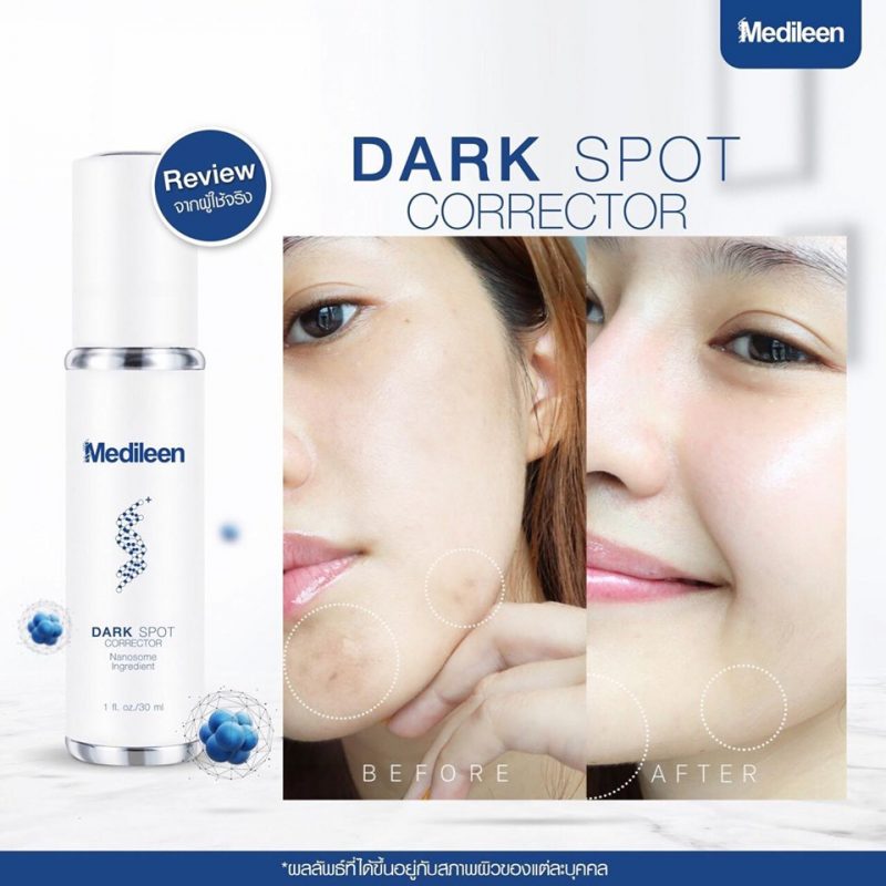 Medileen Dark Spot Corrector