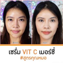 Merci Vitamin C