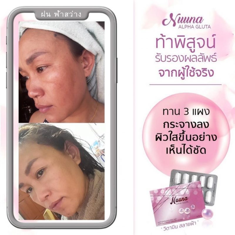 Nuuna Alpha Gluta