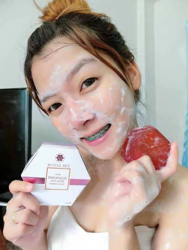 Royal Bee Aloe Propolis Anti-Acne Soap