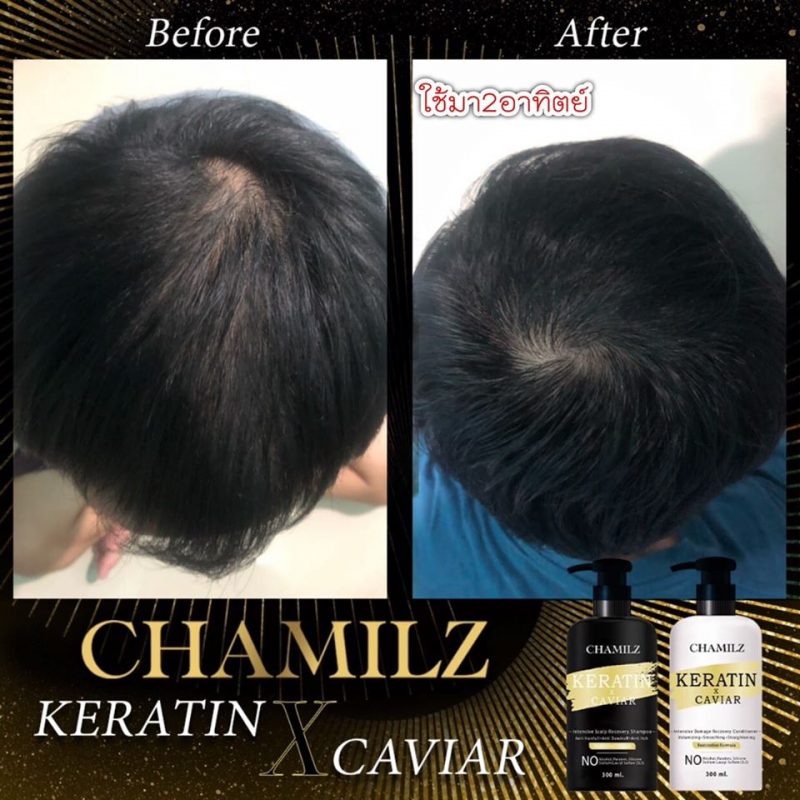 CHAMILZ KERATIN X CAVIAR