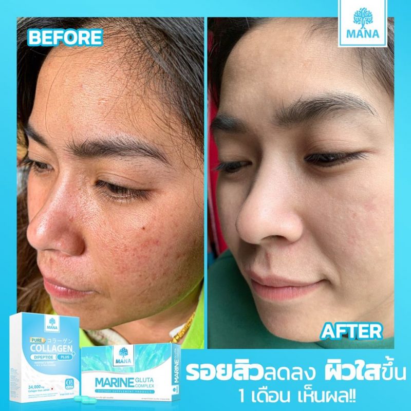 MANA Pure Collagen Plus+