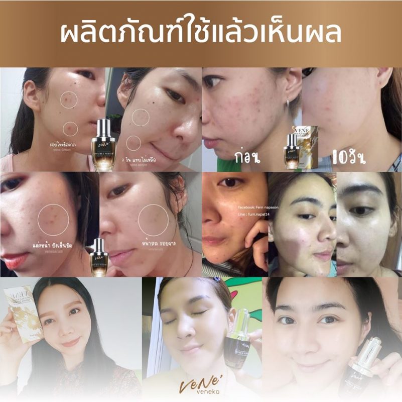Vene Double White Repair Serum