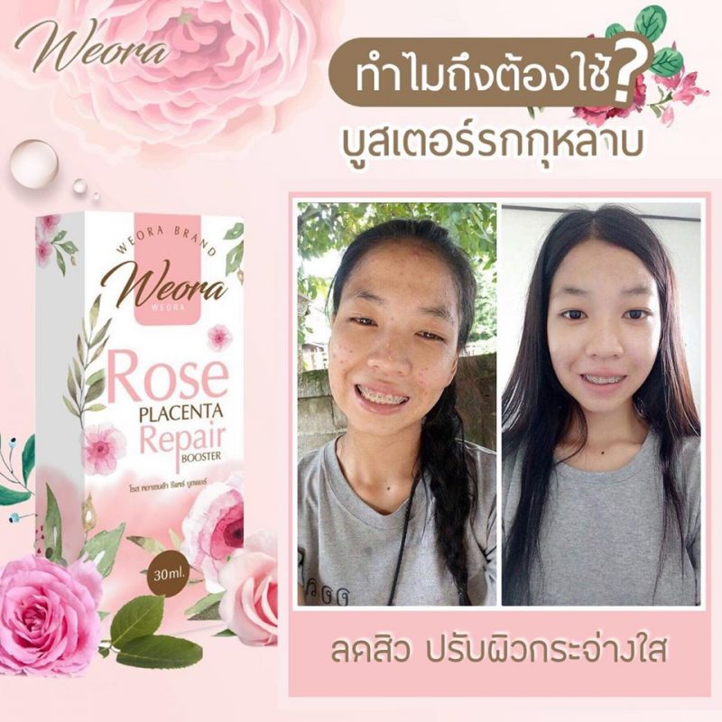 Weora Rose Placenta Repair Booster