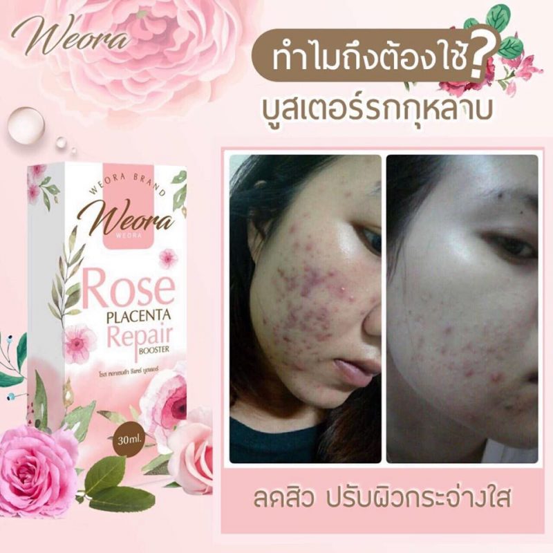 Weora Rose Placenta Repair Booster