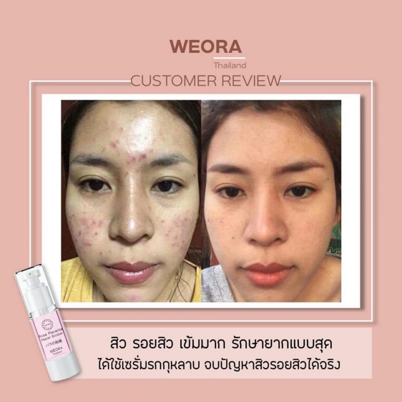 Weora Rose Placenta Repair Booster