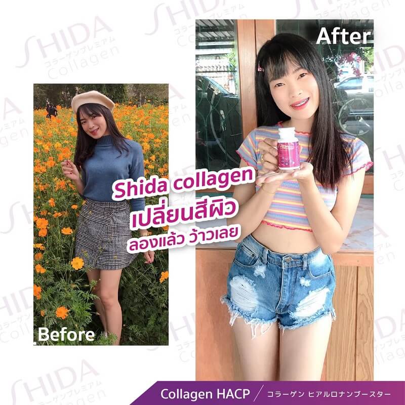 Shida Collagen