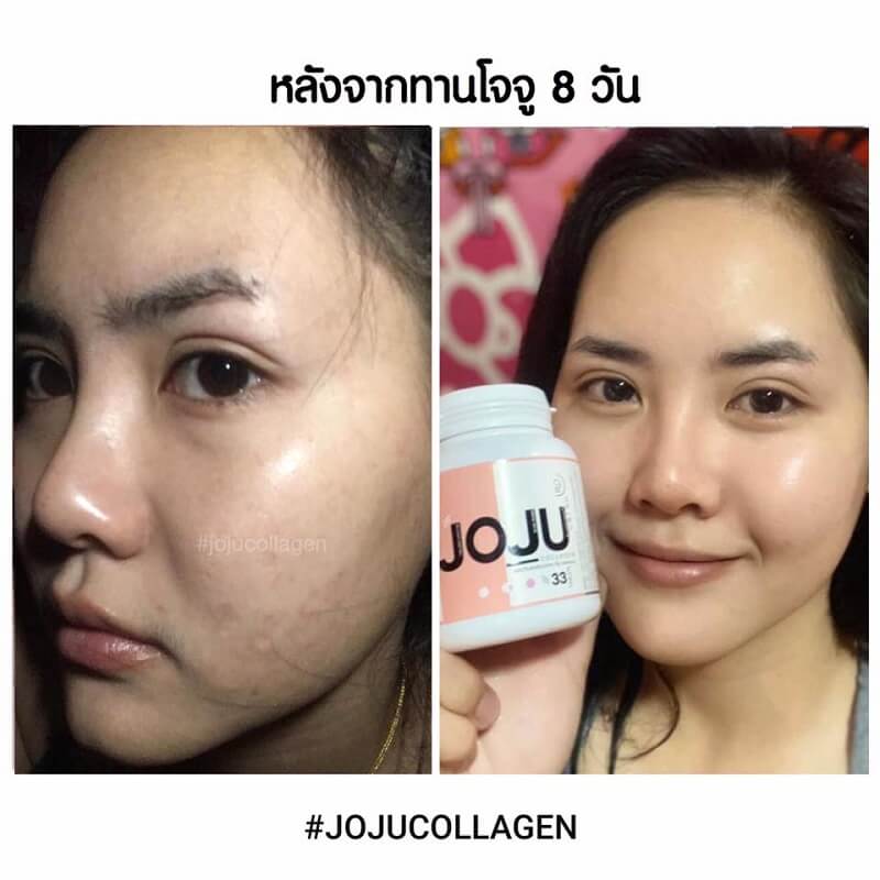 JOJU Collagen