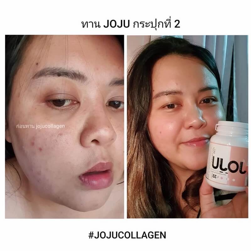 JOJU Collagen