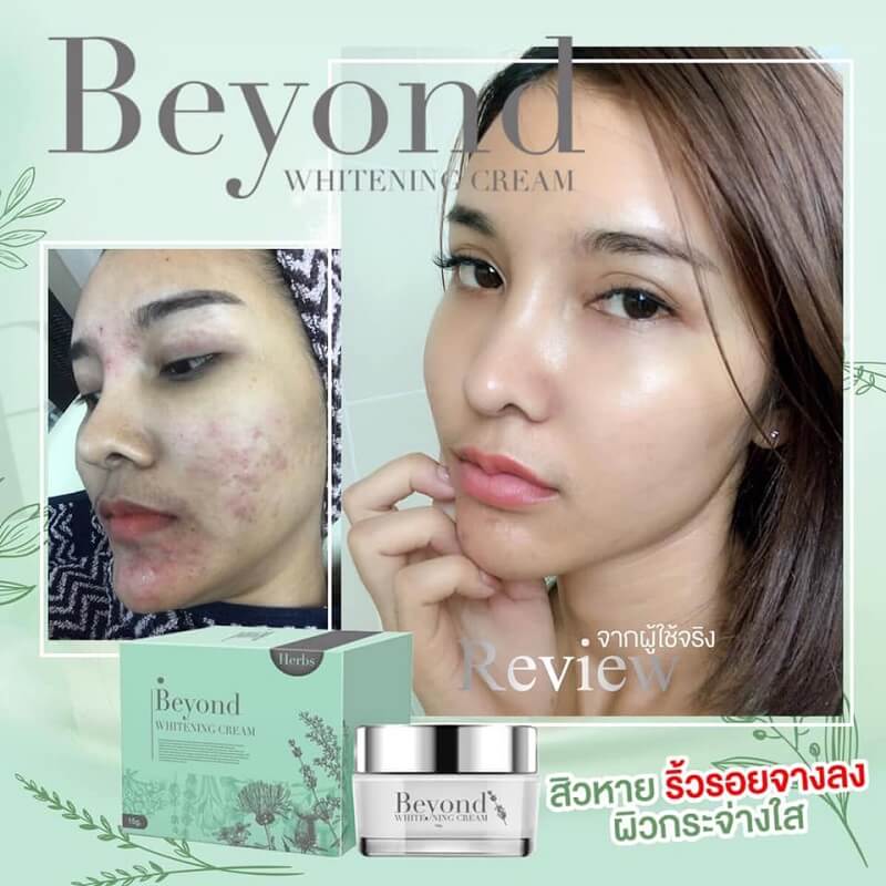 Beyond Whitening Cream