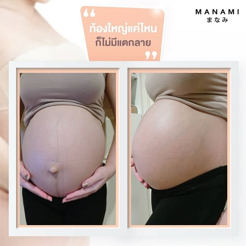 Manami Moisturizing Cream Stretch Mark 