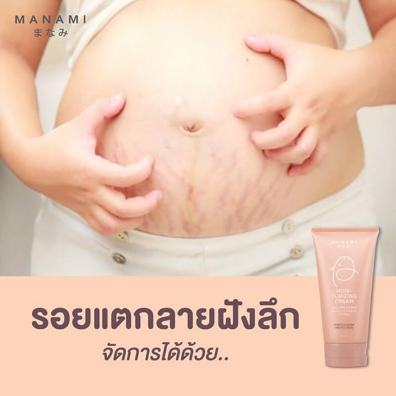 Manami Moisturizing Cream Stretch Mark 