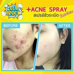 OLD Rock Acne Spray