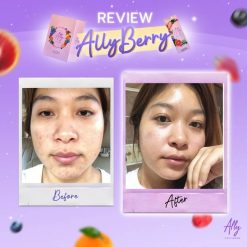 Ally Collagen by Primaya