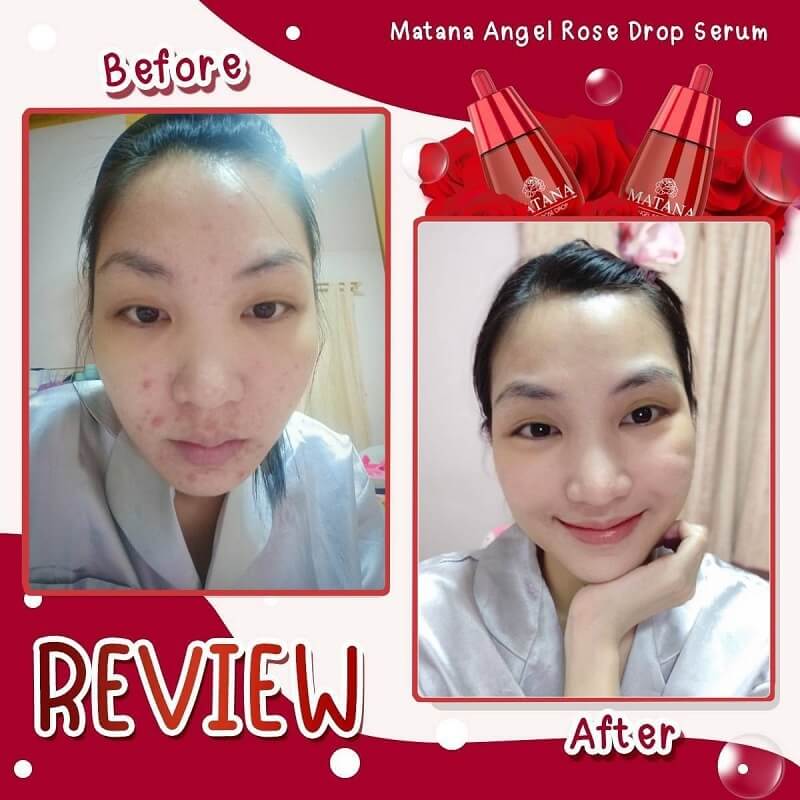 Matana Angel Rose Drop Serum 