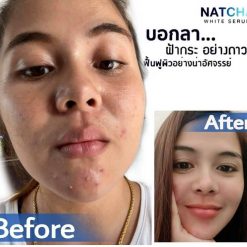 Natcha White Serum