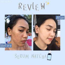 Natcha White Serum