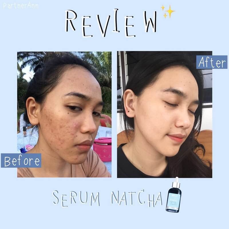 Natcha White Serum 