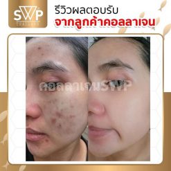 SWP Untimate Collagen Plus