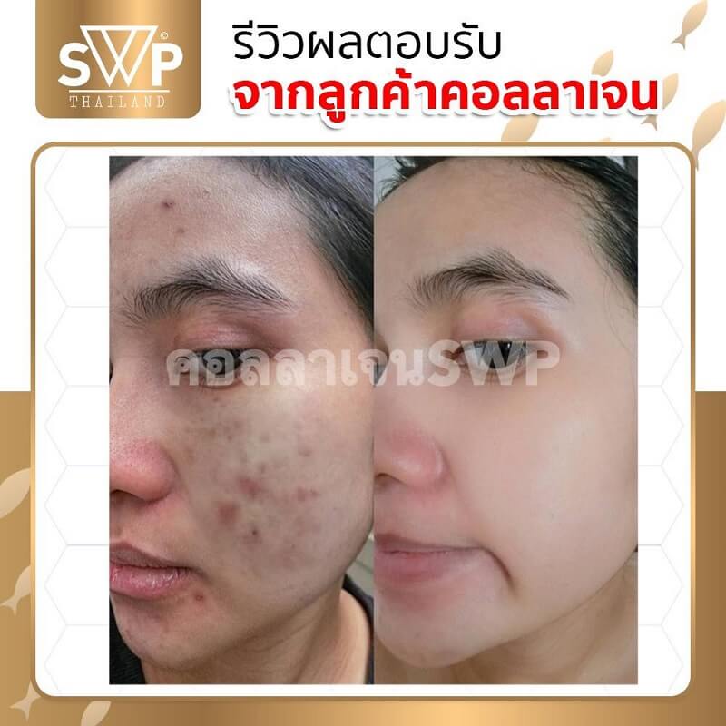 SWP Untimate Collagen Plus 