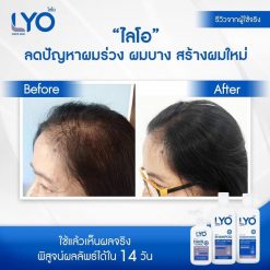 Lyo Hair Tonic
